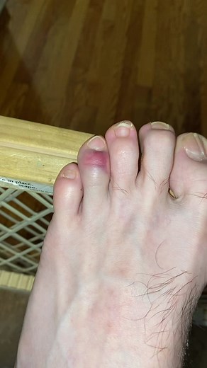 Anyone else done this? #fail #fyp #worldstar #babygate #babygatefail