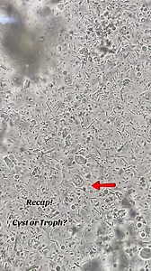 107K views · 976 reactions | Stool sample  #lablife #microbiology | Lab life | Facebook
