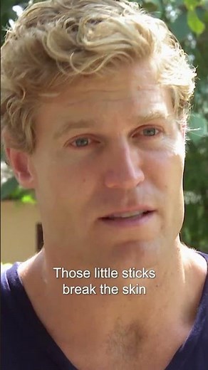 Draining Elephant's Huge Abscesses 🤯 | Bondi Vet #shorts