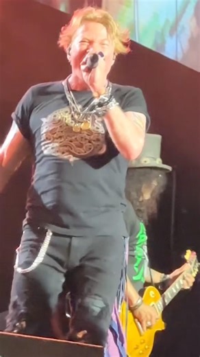 This Is Axl’s Raspy Voice… Better or Worse?