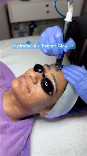 HydraFacial Results ✨ 15% Off in Snellville, Dacula & Athens (Limited Time)