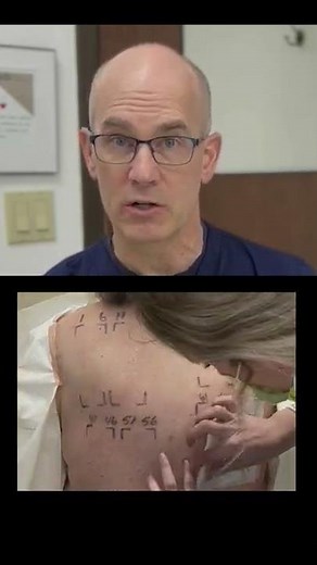 3 Day patch testing at Ada West Dermatology