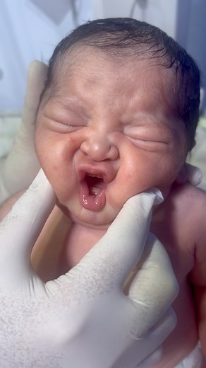 261K views · 18K reactions | #babyfirstminutes #love #baby Beautiful chubby baby with fair moro reflex ❤️ | Baby first minutes | Facebook