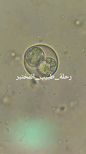 13K views · 162 reactions | Sporulated oocyst of Cystoisospora felis +6 Shape & Size: Round oocyst with a smooth, double-layered wall / Internal Structure: Clearly contains two sporocysts, each with four .sporozoites (total =8 sporozoites) @أبرز المعجبين | رحلة طبيب المختبر | Facebook