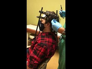 New Pin Installation - Halo Brace