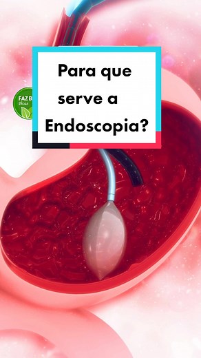 Entenda para que serve a Endoscopia