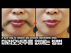 [Eng] Surefire Ways to Prevent Marionette Lines!! How to get rid of marionette wrinkles. | Marion...