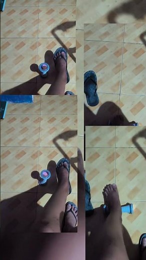 Tibia & Fibula Fracture - exercise for recovery