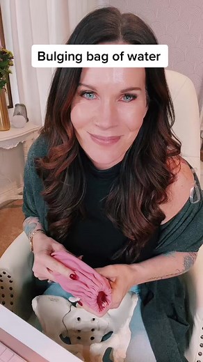 A bulging bag of water is a sign that it will most likely break soon. #childbirtheducation #bulgingbagofwater #amnioticfluid #laboranddeliverynurse