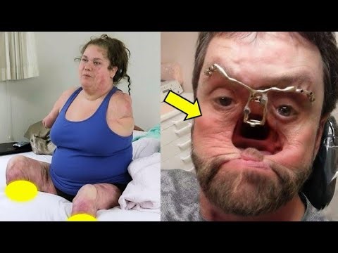 The 10 most unusual and rare people who are unique in the world!! ✨🌍