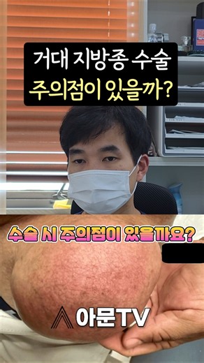 Giant Lipoma Surgery: Are There Risks to Consider? (Plastic Surgery, Giant Lipoma, Benign Tumor, ...