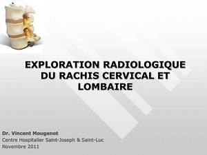 EXPLORATION RADIOLOGIQUE DU RACHIS CERVICAL ET LOMBAIRE - SlideServe