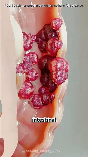 Capsule endoscopy #drone #theflash #space