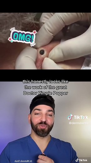 Confirmed this is the work of the great @drpimplepopper #dermatologist #poreofwiner