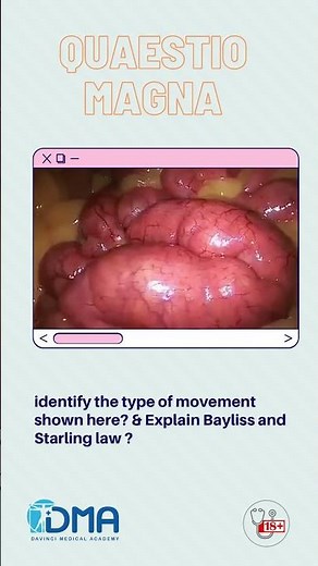 Intestinal peristalsis - OSPE & OSCE | MBBS | NEXT | PLAB | USMLE