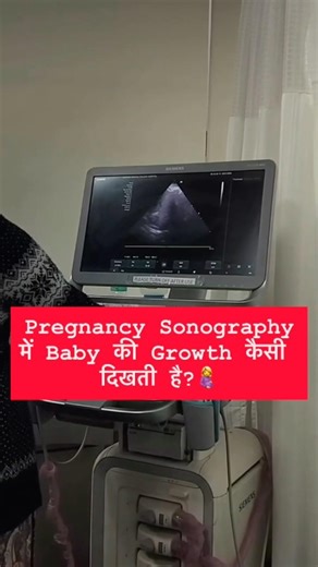 Share this with an expecting mom ♥️ Because this... this is pure love growing, week by week.