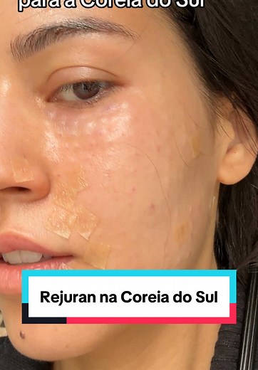 Rejuran: A Must-Try in South Korea