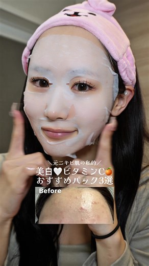 美白に最適なビタミンCパック3選