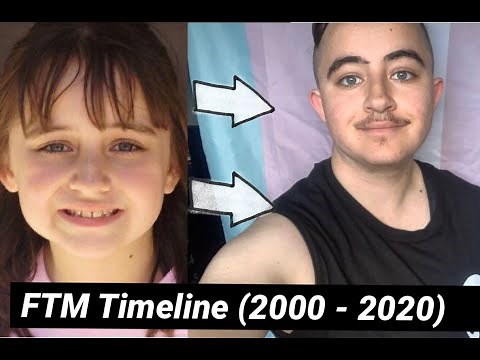 FTM Timeline Transition - 1 year on Testosterone| FabianArtist