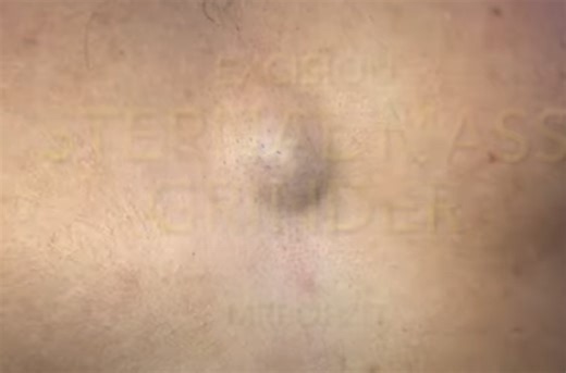 Deep Chest Bump Explosion