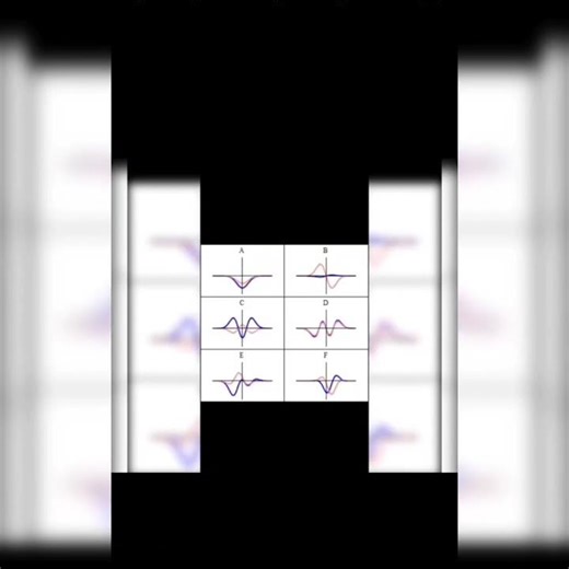 Wave Function Conditions for CSIR NET#csirnet #quantummechanics #mscphysics#physicsnotes#ytshorts