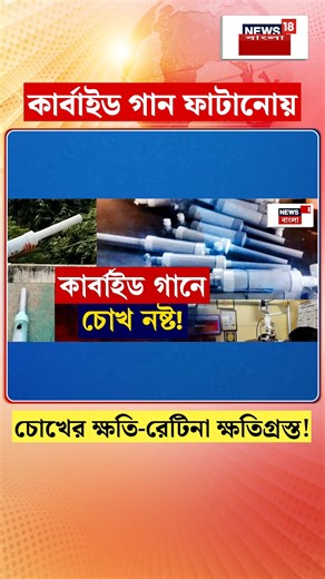 Retina Problem : কার্বাইড গান ফাটানোয় চোখের ক্ষতি-রেটিনা ক্ষতিগ্রস্ত! #News18Bangla #retinaproblem | News18 Bangla
