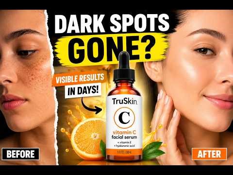 Dark Spots? This Serum Will Transform Your Skin in Days! (Honest Review)