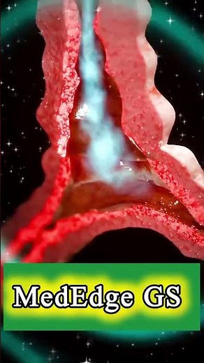 how to use an inhaler