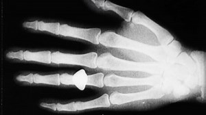 Watch Miracle of X-rays! - BFI Player