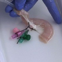 비디오: 인간 3D 체외 종양 검사 시스템의 조직 공학