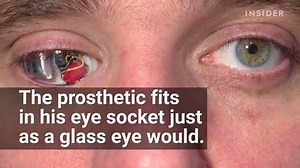 166K views · 1.2K reactions | Meet the eyeborg! This man hacked his prosthetic eye and added a camera. | Open Bionics | Facebook