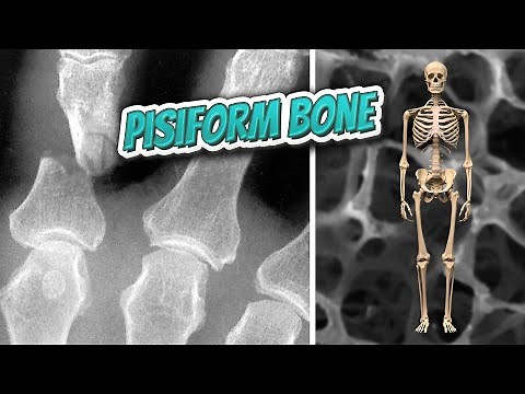 Pisiform bone 🦴 Everything Human Anatomy Bones 🦴