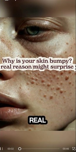 If Your Acne Isn’t Going Away, THESE Are the Real Reasons! #makeup #skincare
