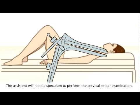 A cervical screening test - What can you expect?