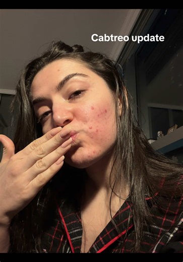 Cabtreo update #skincare #cabtreo #acne #fy #spirinolactone