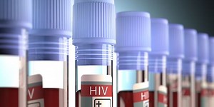 This Woman Had 9 False Positives for HIV While She Was Pregnant