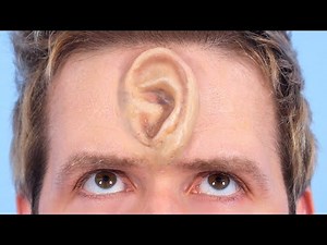 SURPRISE EAR GROWS AFTER SWIMMING IN POOL!
