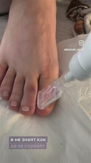 Finish you nail problems with Trinity