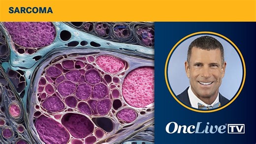 Dr Randall on the Multidisciplinary Foundation of Research Into Sarcoma Survivorship    | OncLive