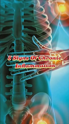 5 Warning Signs of Chronic Inflammation | Supermely Health
