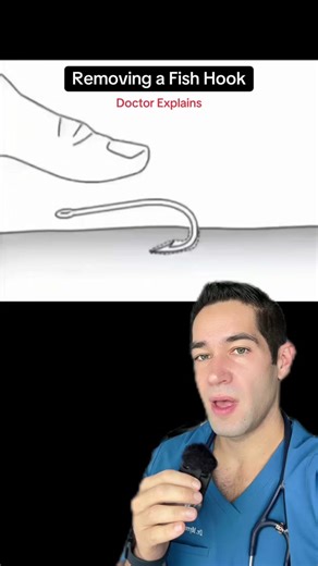 How to Safely Remove a Fish Hook