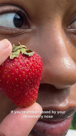 Say goodbye to painful extractions with the Deepcare O2 Hydro-Facial Pore Refiner. This 4-in-1 deep cleansing facial device is powered with dual Hot and Cold modes to vacuum blackheads and excess sebum, as it oxygenates and nourishes with Onsen Water for an ultimate Skin-Tox home facial with dewy, glowing results. 🎁 Use code WELCOME20 for 20% off first purchase 🚚 Free shipping with $40 min. spend | Skin Inc - Skin Supplement Bar