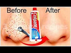 DIY Toothpaste and Salt Blackhead Removal:Get Rid of Blackheads with a Toothbrush