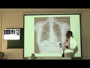 Lecture On Radiology: A Comprehensive Guide to Diagnostic and Interventional Procedures I MBBS