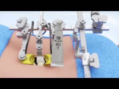 Phantom ML MIS Lumbar Surgical Access System (ML-2000)