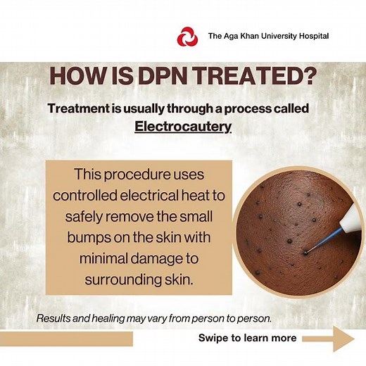 What Is Dermatosis Papulosa Nigra (DPN)? Causes, Symptoms & Treatment Explained