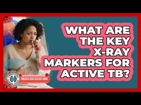 What Are the Key X-Ray Markers For Active TB?