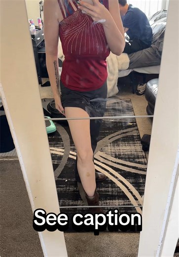 This is what my body with Lipedema and obesity looked like and looks like today. If you want my free mini guide it’s in my profile on what helped. #lipedema #lipedemalegs #lipedemastage1 #weightloss