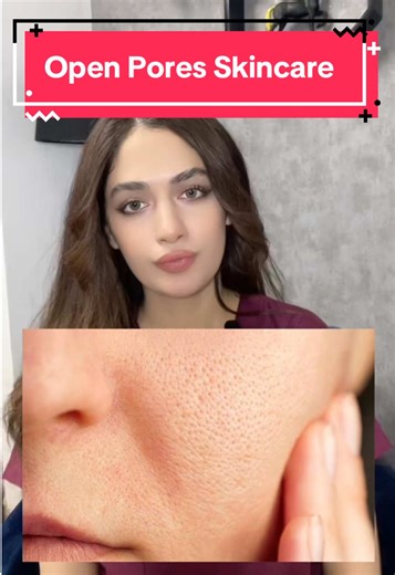 Open Pores Skincare Enlarged pores Large Pores Skincare for enlarged pores #creatorsearchinsights #fypage #fyp #skincare #drmahnoorb #openpores #largepores