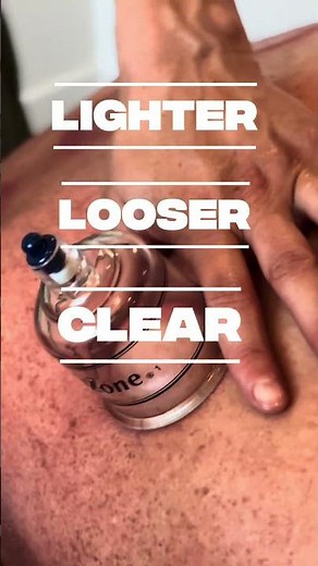 St. George Cupping Therapy: Pain & Stress Relief At Home